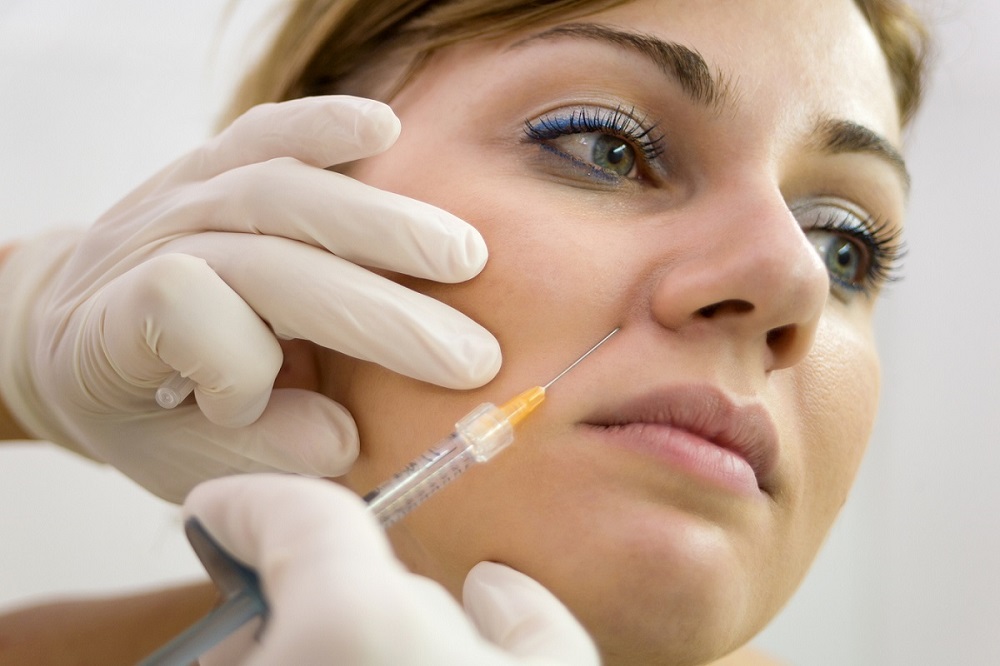Fjerne linjer mellom nese og munn med filler Fjerne linjer mellom nese og munn med filler