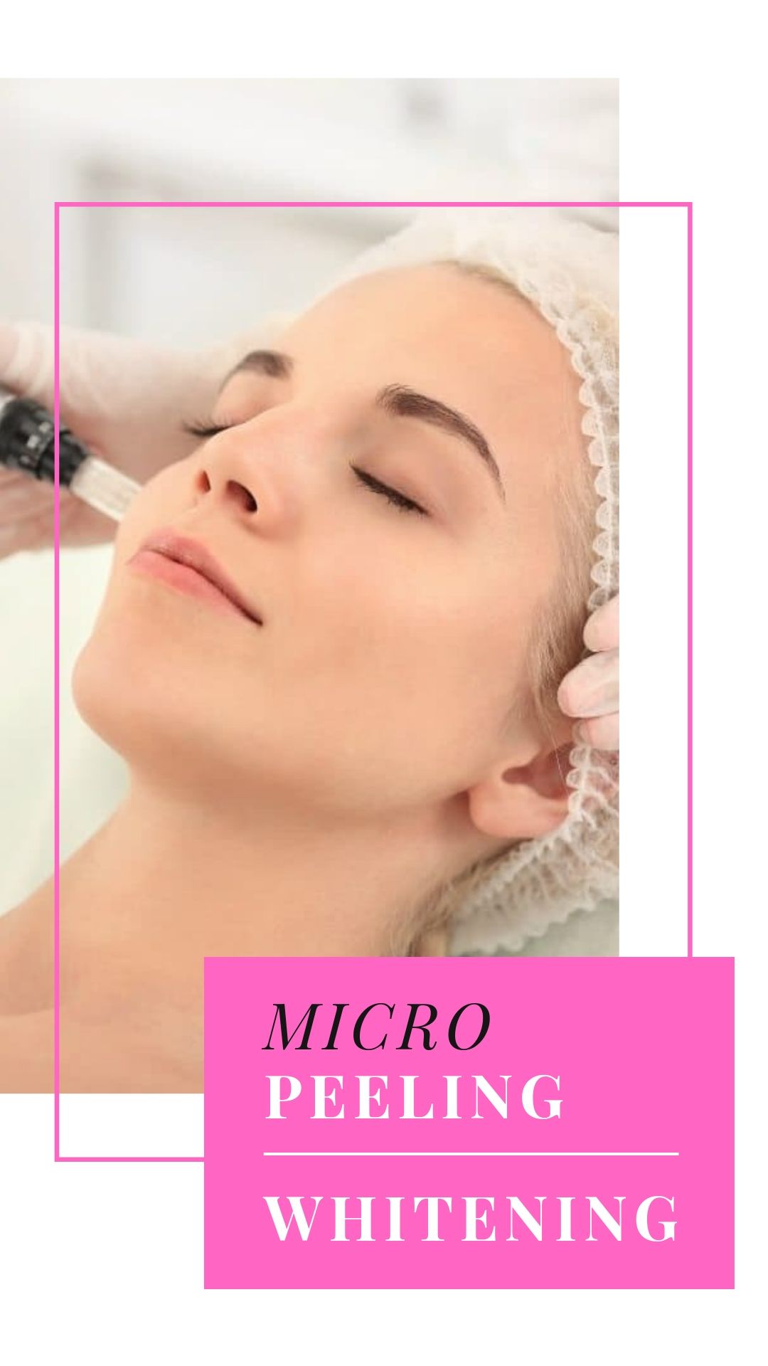 Microneedling - Snapchat